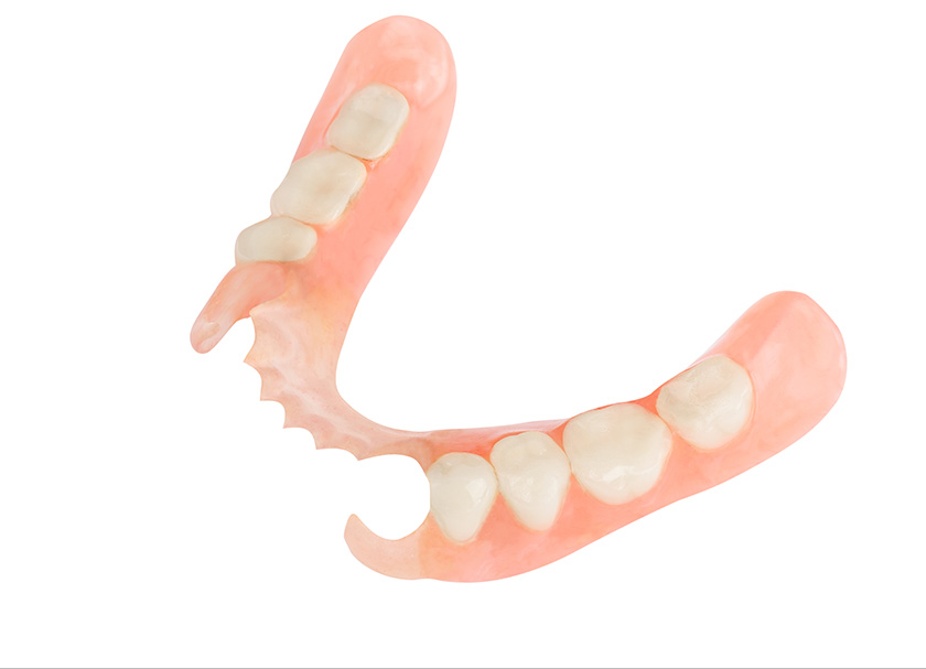 Partial Dentures